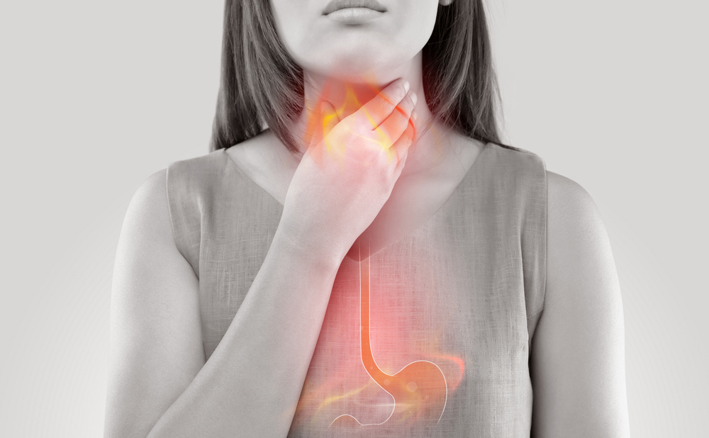 How You Can Manage and Reduce Acid Reflux