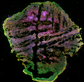 Cross-section of a human brain organoid showing neural stem cells (red) and mature neurons (green).