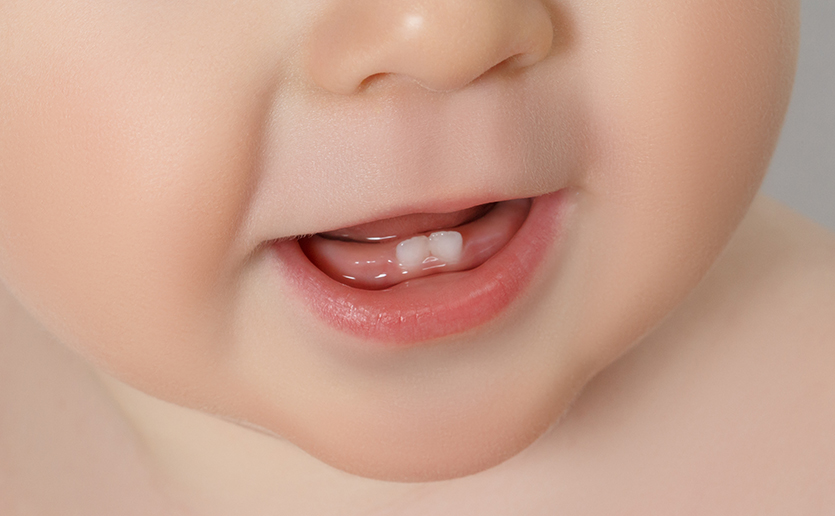 Baby Teeth May Signal Risk of Psychiatric Disorders
