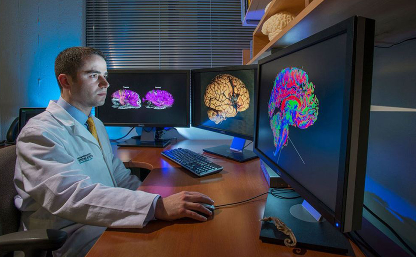 New MRI Brain Scans Provide Unprecedented Detail